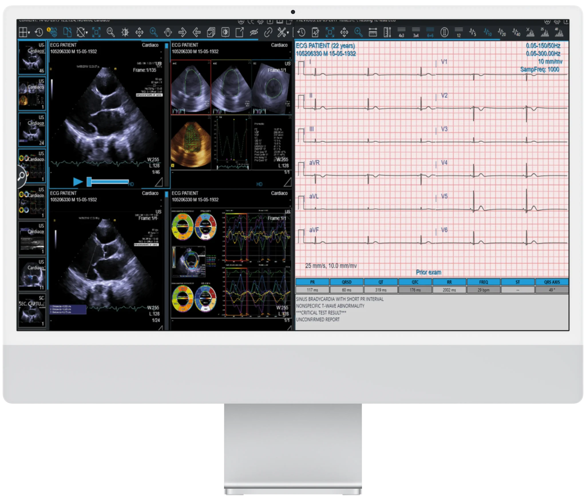 RIS/PACS soluzione integrata